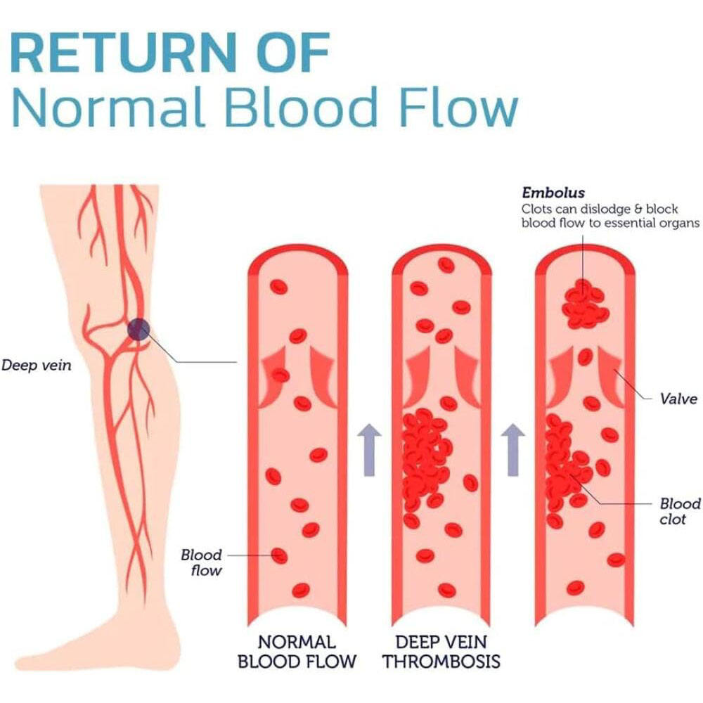 Compression Knee Brace – Full Leg Support for Men & Women, Running & Sports