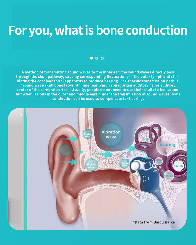 Xsleep Bone Conduction Speaker for Sleep – 3D Audio, Mini Wireless Design, Perfect for Bedtime