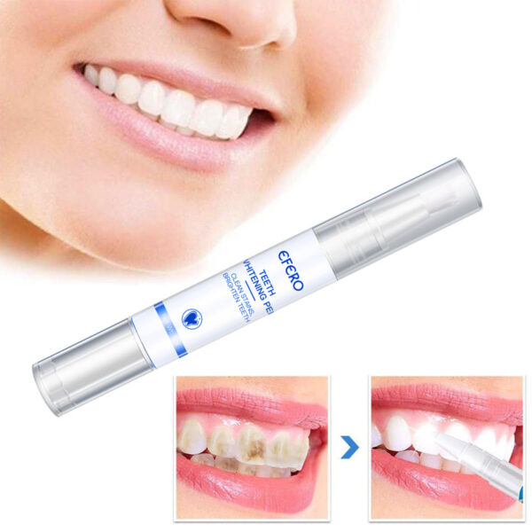 Portable Teeth Whitening Pen for Removing Tobacco Stains and Yellow Teeth for Both Men and Women